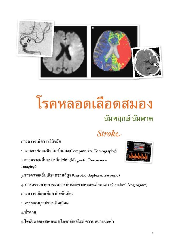 อัมพฤกษ์ อัมพาต 2-page-001